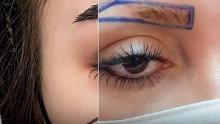 کاشت ابرو در کرج | ابروهای خوش‌فرم، چهره‌ای بی‌نقص