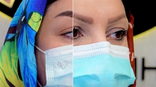 کاشت ابرو در کرج | ابروهای رویایی با یک انتخاب درست