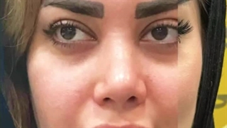 کاشت ابرو در کرج | کاشت ابرو، زیبایی بدون زحمت