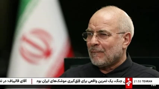 روی خط خبر | مصاحبه با دکتر قالیباف کاشت مو