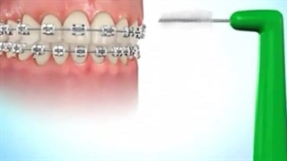 دکتر سیده مریم امیدخدا لیزر موهای زائد