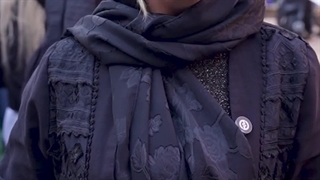 هنرجو ورکشاپ اسکراب اسکالپ ۱