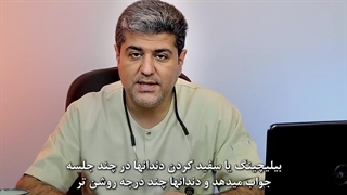 بلیچینگ دندان چقدر مؤثره؟ سفید کردن دندان بدون درد ماموپلاستی