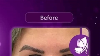 قبل و بعد کاشت ابرو در کلینیک آوینا