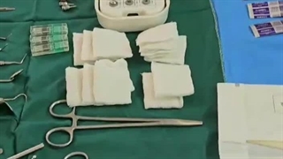 کاشت دندان آقای رضایی در کلینیک دکتر حمید پورصادقی