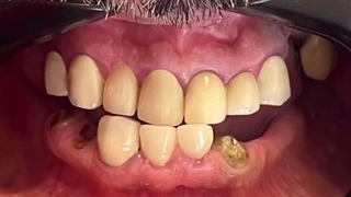کلینیک دکتر الهه صادقی رفع چین و چروک