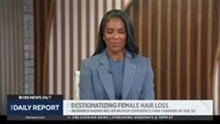 علت ریزش مو در زنان بالای ۴۰ سال