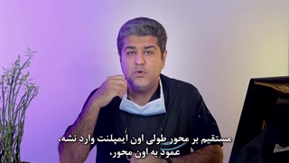 ایمپلنت دندان لق شده؟ علل، درمان و نکات مهم که باید بدانید
