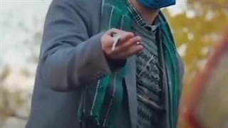 کاشت مو نازنین عسکری در شیراز