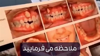 قبول دارید با ارتودنسی هایی که انجام میدیم معجزه اتفاق میفته؟