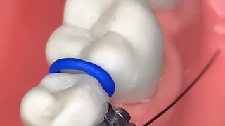 ارتودنسی دندان