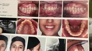 مشکلات فکی رو بدون جراحی اصلاح کن!