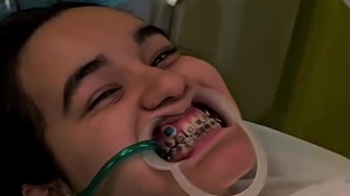 دنیای رنگی ارتودنسی