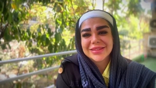 نمونه کاشت ابرو کلینیک لاله