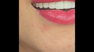 نمونه‌ای واقعی از تغییر لبخند