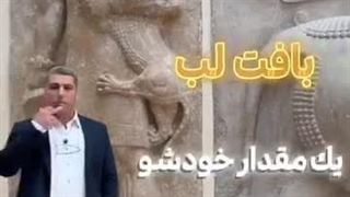 فیلر لب برای چه اشخاصی مناسبه - دکتر علی پرتوی نژاد