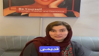 رضایت مراجعه کننده تزریق بوتاکس - کلینیک زیبایی فلورا