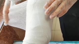 آموزش استفاده از باند و ویبریل (متمم_زخم) 2