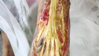 بررسی بیمار (متمم_زخم) 1