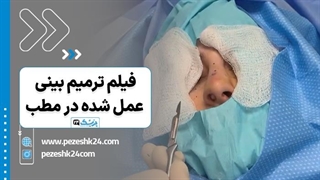 ترمیم بینی عمل شده در مطب - پزشک 24