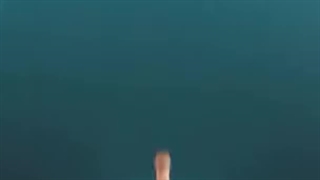 دندانپزشکی با بیهوشی برای چه کسانی است؟