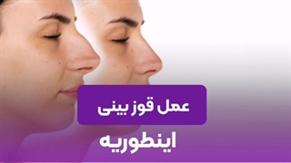 انیمیشن عمل قوز بینی