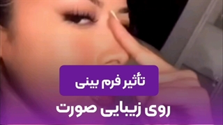 تاثیر فرم بینی روی زیبایی صورت | نقش بینی در تناسب چهره