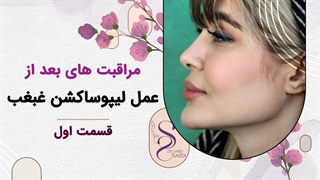 مراقبت بعد از لیپوساکشن غبغب1