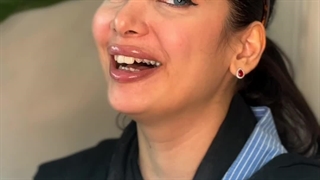 برای زیر 30 ساله ها چه کار زیبایی توصیه میشه؟؟