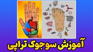 راز موفقیت در سوجوک تراپی | پکیج کامل یادگیری سوجوک