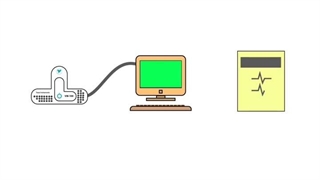 فرآیند سفارش هولتر قلب
