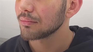 عمل بینی فانتزی مردانه در کلینیک مسیح