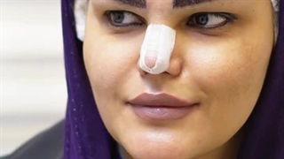 کلینیک زیبایی الهام - سایت بهترین در تهران