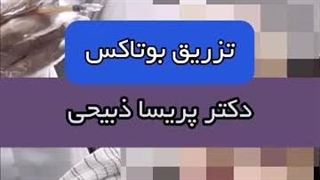 بوتاکس طبیعی بدون افتادگی | تجربه یکی از مراجعین مشهد