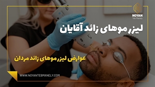 لیزر موهای زائد آقایان - لیزر خط ریش مردان با دستگاه لیزر کندلا