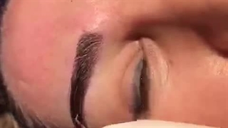 کاشت ابرو در کلینیک آوینا