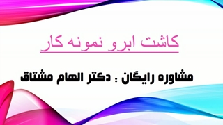 کاشت ابرو نمونه کار
