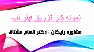 نمونه کار تزریق فیلر لب