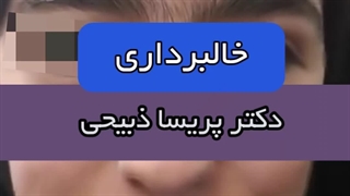 حذف خال بدون جای زخم تجربه خالبرداری با دکتر پریسا ذبیحی