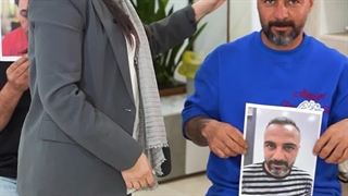 «قبل و بعد کاشت مو | سه مراجع واقعی آرمو کلینیک»