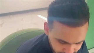 نمونه کاشت موفق مو