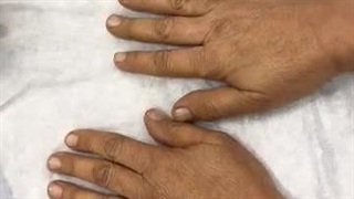 تجربه فیشال دست در کلینیک دوما