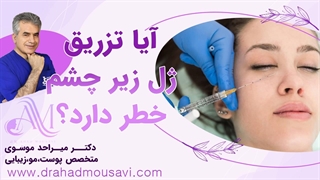 آیا فیلر زیر چشم ایمن است یا می‌تواند خطرناک باشد؟