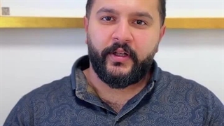 نمونه کاشت مو دکتر جلیلی فر