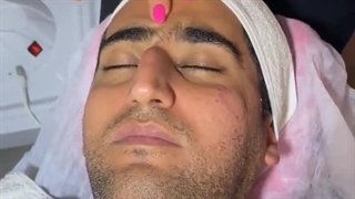 فیشیال جوان‌ساز ملایم | آی گل