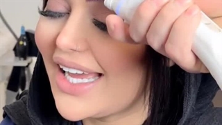 لیزر تراپی سرد بعد از کاشت ابرو در کلینیک تخصصی رنسانس