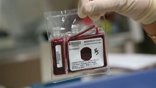 هزینه ذخیره‌سازی بانک خصوصی خون بند ناف