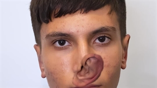 عمل عجیب گوش های بَل!! چقدر تغییر لاکچری‌ای کرد!