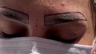 کاشت ابروی حرفه‌ای با نتایج چشمگیر