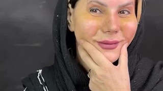 رضایت از عمل بینی بدون بیهوشی در درمانگاه مسیح